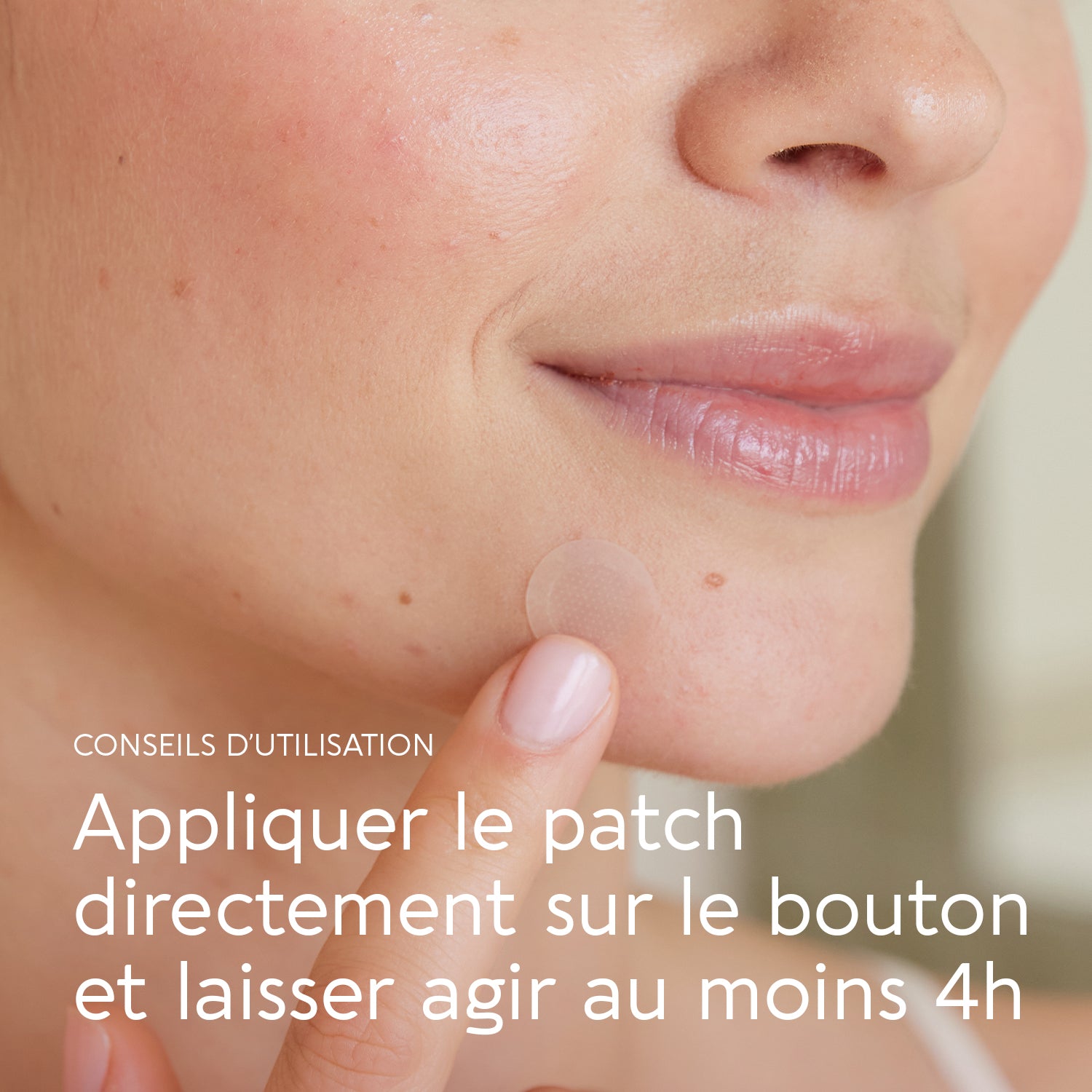 biocyte-k-biocyte-active-pimple-patch-boutons-salicylique image 4