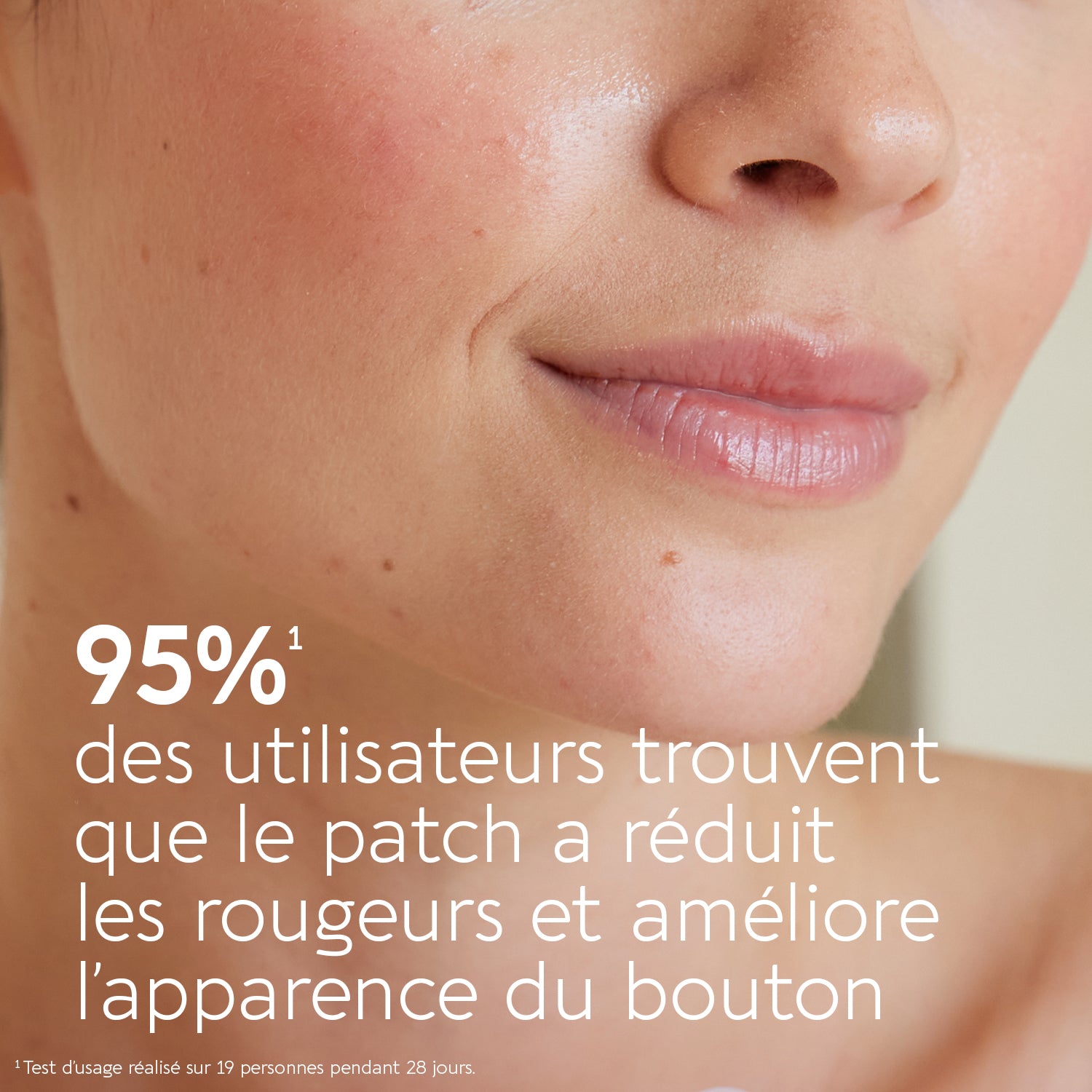 biocyte-k-biocyte-active-pimple-patch-boutons-salicylique image 3